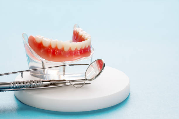 Dental Inlays and Onlays in Geistown, PA